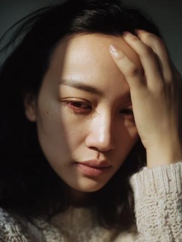 中医妙招！面瘫不再烦恼