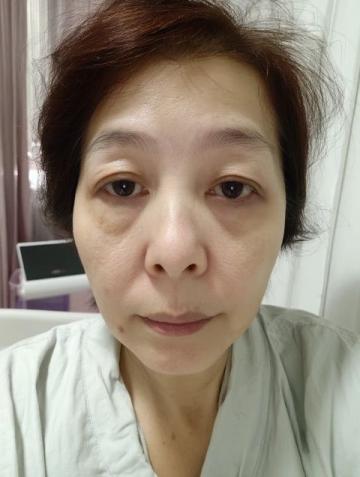 60岁无医美,每天两顿饭坚持10年养生闭环