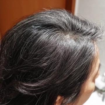 中医认为,白发多往往是肝肾不足、气血亏虚的体现。以下四项运动可以帮助你疏通经络、补充精血。