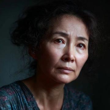 中医妙招!面瘫不再烦恼