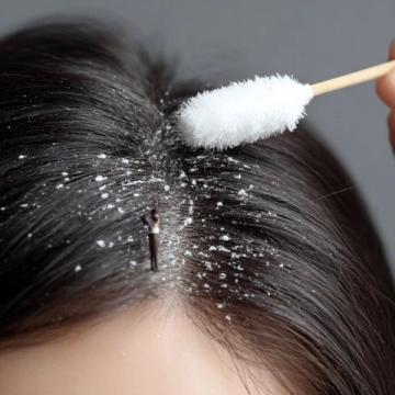 中医认为,白发多往往是肝肾不足、气血亏虚的体现。以下四项运动可以帮助你疏通经络、补充精血。