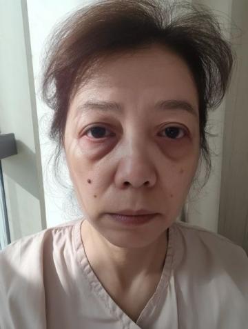女子试着穿上艾灸鞋一分钟后全身感到温暖舒适且有益健康