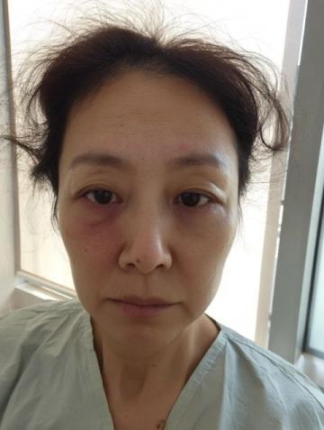 女子试着穿上艾灸鞋一分钟后全身感到温暖舒适且有益健康