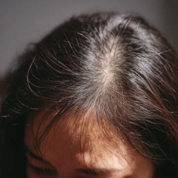 中医认为,白发多往往是肝肾不足、气血亏虚的体现。以下四项运动可以帮助你疏通经络、补充精血。