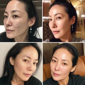 60岁无医美，每天两顿饭坚持10年养生闭环